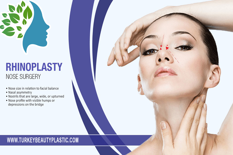 Rhinoplasty